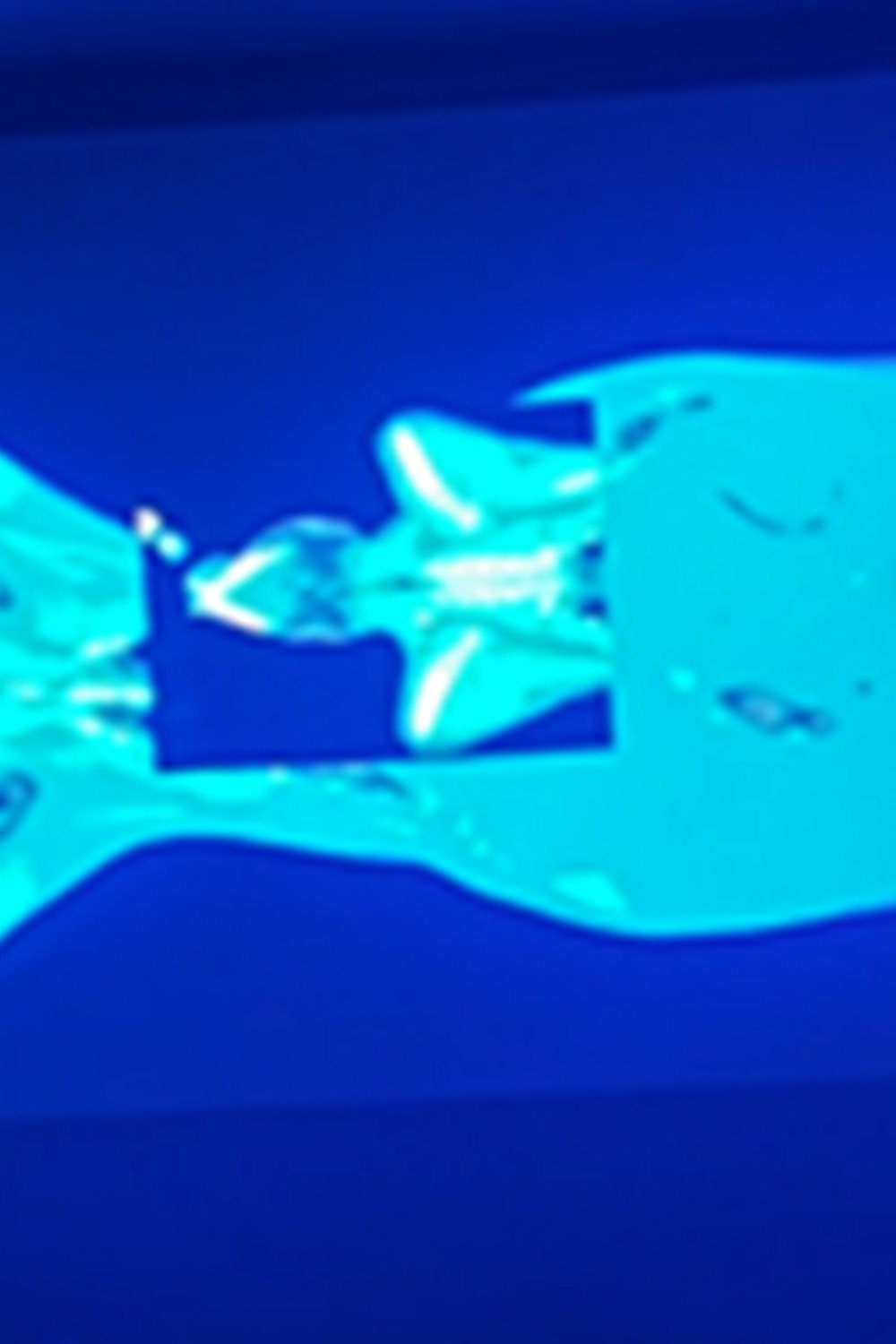 X-Ray Katx poster